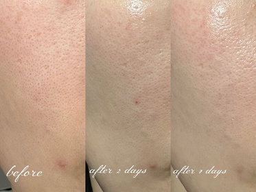 Hchan-OLAY胜肽專研緊緻修護安瓶精華_2