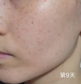 Yanice-CAUDALIE白藜蘆醇提昇緊緻精華_3