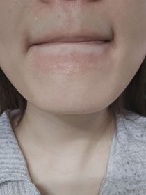 pam0421-CeraVe長效保濕修復乳_3