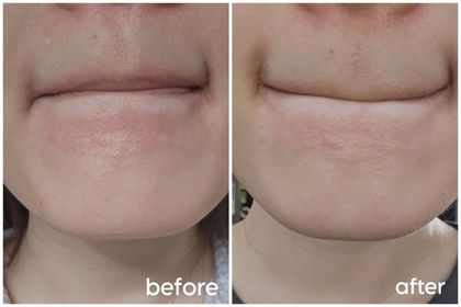 pam0421-CeraVe長效滋潤修復霜_3