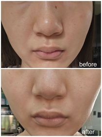 pam0421-CeraVe長效滋潤修復霜_4