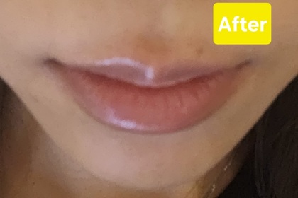 Abbyanna0127-MENTHOLATUM 曼秀雷敦LIP PURE OIL 天然植物精華油潤唇膏(無香料)_2