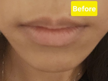 Abbyanna0127-MENTHOLATUM 曼秀雷敦LIP PURE OIL 天然植物精華油潤唇膏(無香料)_3