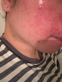 Vlee-CeraVe長效保濕修復乳_2