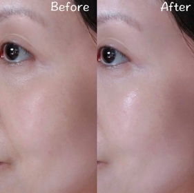 Emily Chow-Vaseline凡士林®特潤修護精華雪融霜_4