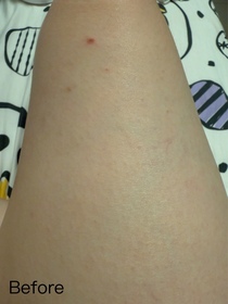 ChingLam-Vaseline凡士林®特潤修護精華雪融霜_3