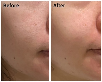 pillowjai-Vaseline凡士林®特潤修護精華雪融霜_2