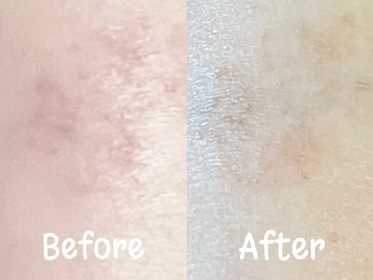 Kirby-Vaseline凡士林®特潤修護精華雪融霜_2