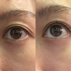 Poyobb-HADA LABO 肌研Premium煥活抗皺滋養眼霜_3