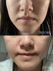 TT-HADA LABO 肌研H.A. Supreme 透亮活力精萃水_4