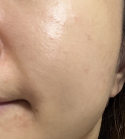 chasiutung-HADA LABO 肌研H.A. Supreme 活顏緊緻面霜 #水光燈_2