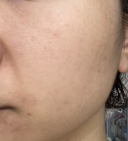 chasiutung-HADA LABO 肌研H.A. Supreme 活顏緊緻面霜 #水光燈_3