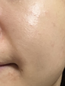 chasiutung-HADA LABO 肌研H.A. Supreme 透亮活力精萃水_1