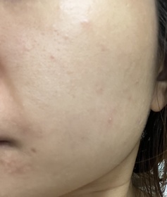 chasiutung-HADA LABO 肌研H.A. Supreme 透亮活力精萃水_2