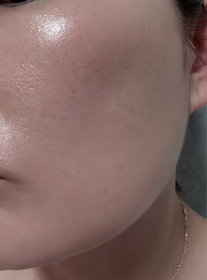 Catcmc-HADA LABO 肌研H.A. Supreme 透亮活力精萃水_2