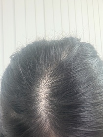 Judy-Hair Recipe 防脫黑米瓶洗髮露_3