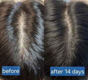 wookayee02150-Hair Recipe 防脫黑米瓶洗髮露_2
