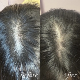 Haidy-Hair Recipe 防脫黑米瓶洗髮露_2