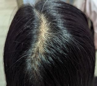 CC-Hair Recipe 防脫黑米瓶洗髮露_3