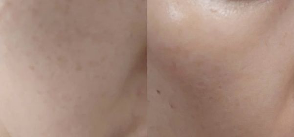 Emily Leung-IPSA美白淨斑精華_2