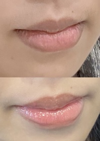 Sakura醬-MENTHOLATUM 曼秀雷敦LIP PURE 蜂蜜潤唇膏_3
