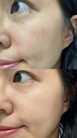 cha8076-Suu Balm速效舒敏修護面霜 _1