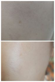 Kitty -SK-IISKINPOWER能量精華_3