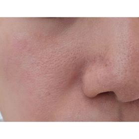 lonia-SOFINA iP毛孔淨澈重點洗顔啫喱_4