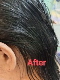 Anna-YVES ROCHER防脫豐盈精華_3