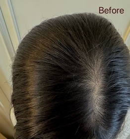 Jolicious-YVES ROCHER防脫豐盈精華_3