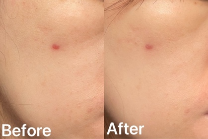 Ntra-SOFINA iP全效透潤調肌精華液_2