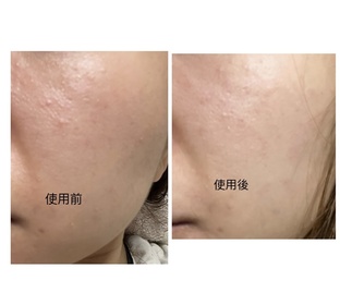 chasiutung-SOFINA iP全效透潤調肌精華液_2