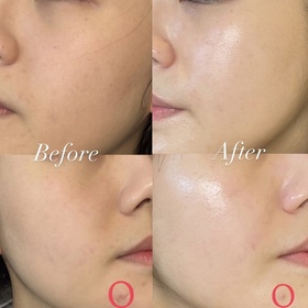 Haidy-SOFINA iP全效透潤調肌精華液_1