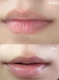 Kathy Wai-MENTHOLATUM 曼秀雷敦LIP PURE OIL 天然植物精華油潤唇膏(無香料)_1