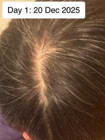 winniemaow-YVES ROCHER防脫豐盈精華_3