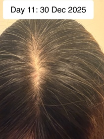 winniemaow-YVES ROCHER防脫豐盈精華_4