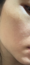 Rin-DECORTÉVITA DE REVE_2