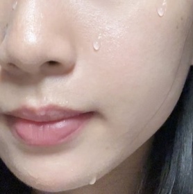 Emily Leung-CeraVeSA水楊酸煥膚潔膚露_1