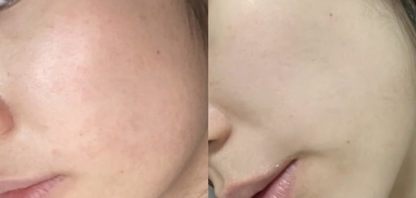 Emily Leung-LA ROCHE-POSAYCICAPLAST B5萬用修復霜_1