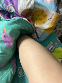 frogfrogtina-NIVEA舒敏修復潤膚露_3