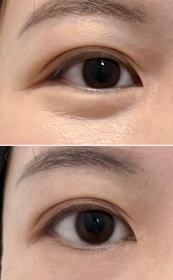 Myonlyone-SkinCeuticals活膚緊緻眼霜_3