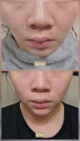 Livena  Shing-OLAY胜肽專研緊緻修護安瓶精華_2