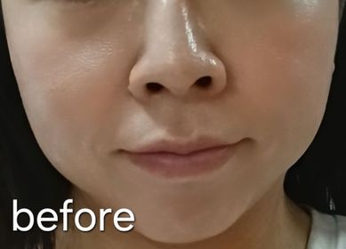 mandy-LANCÔME升級版嫩肌活膚精華面膜_2