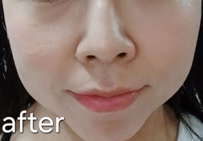 mandy-LANCÔME升級版嫩肌活膚精華面膜_4