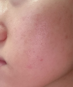 zetalhc-Curél碳酸泡沫精華_3