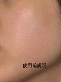 Choi-Curél碳酸泡沫精華_3