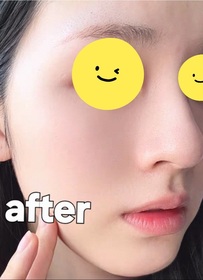 Fng-Spa treatmentB5冰萃水光瓶_1