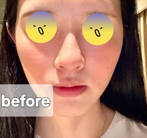 Fng-Spa treatmentB5冰萃水光瓶_2