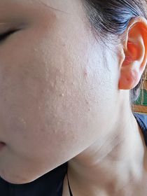 karun-BIODERMA 貝膚黛瑪保濕卸妝潔膚水_2