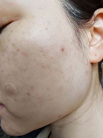 karun-BIODERMA 貝膚黛瑪保濕卸妝潔膚水_3